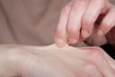 5 giây kiểm tra mức độ lão hóa: Da bao nhiêu tuổi biết ngay