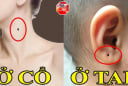 Những nốt ruồi Thần Tài 'đánh dấu', số 3 muốn nghèo cũng khó