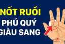 5 nốt ruồi trên tay Ăn May Cả Đời, có 1/5 cũng sướng