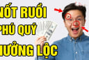 4 nốt ruồi thần Tài để lại, ai có 1/4 Lộc hưởng đến già