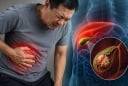 3 dấu hiệu cảnh báo viêm túi mật nặng