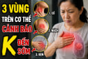 3 vùng trên cơ thể cảnh báo K đến sớm