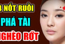 3 nốt ruồi chặn cửa Tiền Tài: Có 1/3 bạn cũng đủ lao đao, đừng cố giữ lại chỉ hao tài