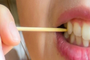 Thói quen nhiều người cứ ăn xong là làm khiến răng càng ngày càng thưa, thậm chí teo nướu