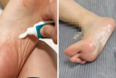 Tác dụng tuyệt vời của việc bôi kem đánh răng vào lòng bàn chân, cả nam và nữ đều hưởng lợi