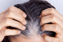 Tại sao tóc bạc sớm và có nên nhổ tóc bạc?