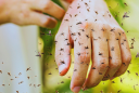 Mẹo đơn giản giúp giảm ngứa cực nhanh khi bị muỗi và côn trùng đốt