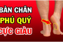 Người có 3 điểm này trên bàn chân: Không thành tỷ phú cũng là đại gia