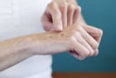 Mẹo chữa nám da tay bảo dưỡng làn da mướt mịn