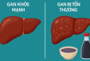 Cảnh báo: Loại gia vị quen thuộc này có thể âm thầm hại gan mà nhiều người Việt chưa biết