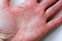 Tay có vân tam giác, giàu đến 90 tuổi: Bí ẩn đường chỉ tay hé lộ vận mệnh