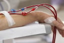 7 dấu hiệu suy thận giai đoạn cuối: Chủ quan tính mạng tính bằng tháng