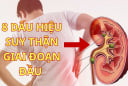 8 Dấu Hiệu Suy Thận Giai Đoạn Đầu: Phát hiện sớm cứu cả cuộc đời