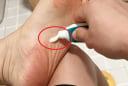 Bôi kem đánh răng vào lòng bàn chân trước khi ngủ, việc nhỏ mà lợi ích to