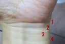 Nhìn vào 4 ngấn cổ tay: Biết ngay cuộc đời sung sướng Tiền Nhiều hay Nghèo Khổ