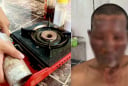 Bình gas mini phát nổ, 8 người nhập viện, lưu ý cách dùng để tránh họa bình gas mini