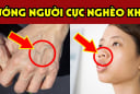 Người có 3 nét tướng này càng sống càng Bạc Phúc: Trẻ thì ốm đau hao tài, già thì cô độc nghèo khổ