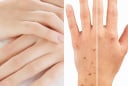 Mu bàn tay tiết lộ bí mật sống thọ: 4 dấu hiệu ai cũng nên kiểm tra
