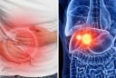 “2 đau 1 vàng” dấu hiệu cảnh báo ung thư gan đang âm thầm phát triển: Chủ quan tính mạng tính từng ngày
