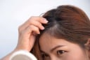 3 loại dinh dưỡng quan trọng này, nếu thiêu dễ khiến tóc bạn bạc sớm