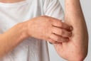 4 dấu hiệu cảnh báo K sớm: Có 1 cũng nên đi khám sớm