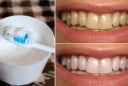 Đánh răng bằng thứ này, làm sạch mảng bám, tẩy trắng răng, không mòn men răng