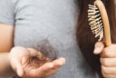 Càng ăn 5 loại thực phẩm này, tóc càng rụng nhiều: Món số 1 được nhiều người yêu thích