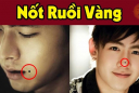 4 nốt ruồi Vàng cực kỳ Hút Lộc: Ai có được giàu có 3 đời