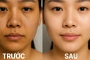 Rửa mặt bằng giấm gạo: Bí quyết làm đẹp 'ngon, bổ, rẻ' giúp da sáng căng, mờ mụn chỉ sau vài tuần