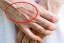 Vì sao tay xuất hiện gân xanh? Cẩn thận nếu bạn có ở những vị trí này!