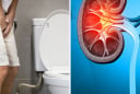 3 dấu hiệu vào ban đêm cảnh báo bệnh thận: Bỏ lỡ hối hận cả đời