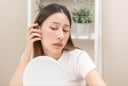6 thói quen phổ biến khiến nám da ngày càng nặng hơn