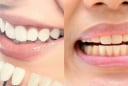 Nhìn màu răng đoán bệnh: Bác sĩ cảnh báo dấu hiệu nguy hiểm nhiều người bỏ qua