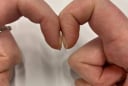 4 dấu hiệu bất thường trên ngón tay cảnh báo sớm ung thư gan, phổi