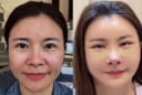 Kim Oanh lên tiếng sau khi gây tranh cãi vì phẫu thuật thẩm mỹ cả gương mặt