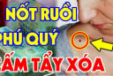 5 nốt ruồi tựa hố chôn tiền: Ai có được thật đáng chúc mừng