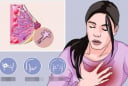4 loại ung thư có tỷ lệ sống sót gần 100%, trong đó có ung thư vú – Đừng vội từ bỏ điều trị