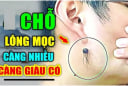 3 chỗ mọc lông Ngồi Không cũng có Tiền, số 1 nhiều người không biết lại nhổ đi