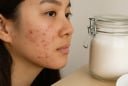 Ăn quá nhiều đường mà không biết: 7 dấu hiệu âm thầm dễ bị bỏ qua