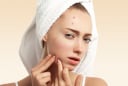 3 nguyên tắc cơ bản khi giảm sưng mụn viêm giúp da khỏe và nhanh láng mịn