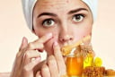 Mật ong hoàn toàn có thể trở thành “trợ thủ” cho da mụn nếu nàng nắm rõ những điểm sau