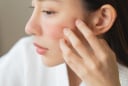 4 thói quen tưởng chừng vô hại nhưng lại khiến da dễ sạm nám