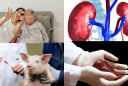 Ca ghép thận lợn đầu tiên ở châu Á sống hơn 200 ngày
