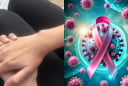 Gia tăng tình trạng Vợ Chồng cùng bị K, chuyên gia chỉ ra các nguyên nhân, các gia đình chú ý