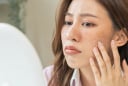 Sai lầm khiến tình trạng nám và đốm đen trở nên trầm trọng