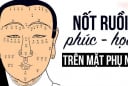 4 nốt ruồi chặn cửa tài lộc: Nên xóa bỏ