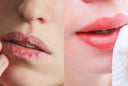Cách trị môi khô nứt nẻ bằng nguyên liệu sẵn có tại nhà để mùa đông khô hanh nhưng môi vẫn căng mọng