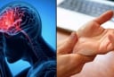 Cảnh báo đột quỵ: Dấu hiệu nhận biết trước 1 tuần, tuyệt đối không được bỏ qua