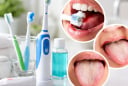 5 dấu hiệu khi đánh răng có thể cảnh báo cơ thể đang gặp vấn đề nguy hiểm, đừng chủ quan