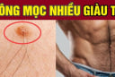 3 vị trí càng nhiều lông càng giàu có